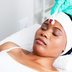 I Tried RF Microneedling: Here’s What You Need to Know