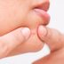 Everything You Need to Know About Hormonal Acne—and How to Clear It for Good