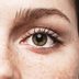 Yes, Eye Freckles Are a Thing—and This Is What They Reveal About Your Health