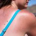 9 Clear Signs You’ve Gotten Too Much Sun