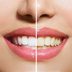 Yellow Teeth Are Actually Stronger Than Bright White Teeth—Here’s Why