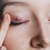How to Get Rid of a Stye—the Right Way