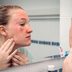 7 Reasons You Get Hives on Your Face—and What to Do About Them