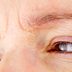 Yes, Eyebrow Dandruff Is Real—Here's How to Treat It