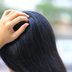 Is It Scalp Psoriasis or Dandruff? Here’s How to Tell the Difference