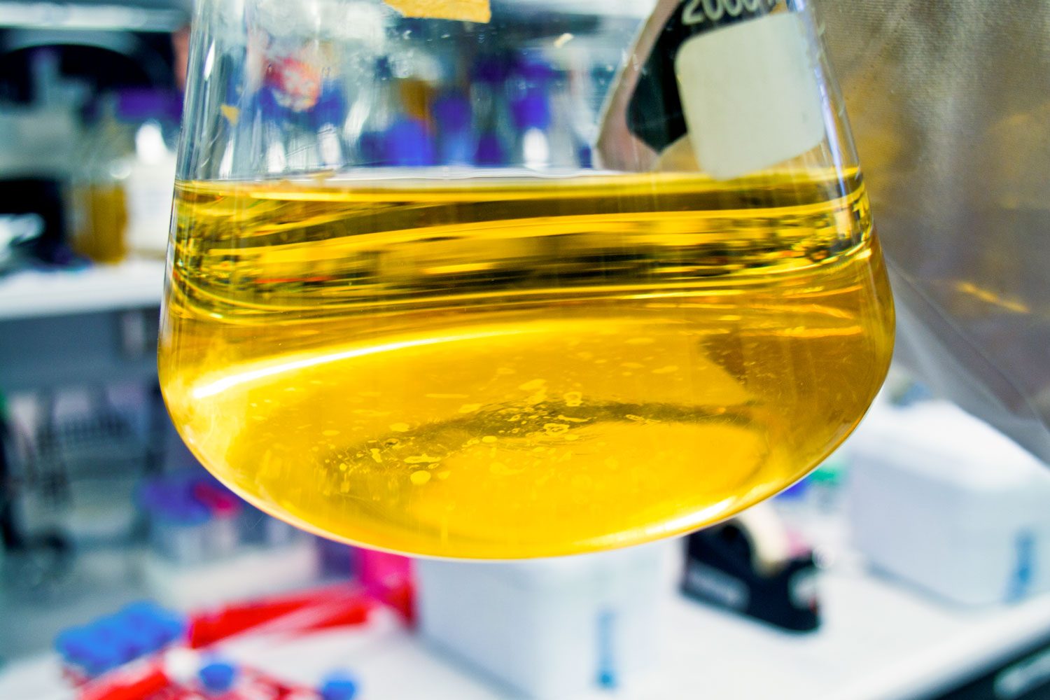 Mucus in Urine: What Causes It and When To See a Doctor